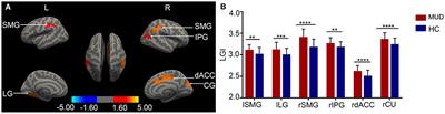 Brain morphometric abnormalities and their associations with affective symptoms in males with methamphetamine use disorder during abstinence